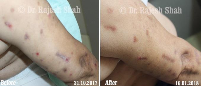 lifeforce homeopathy case-photos